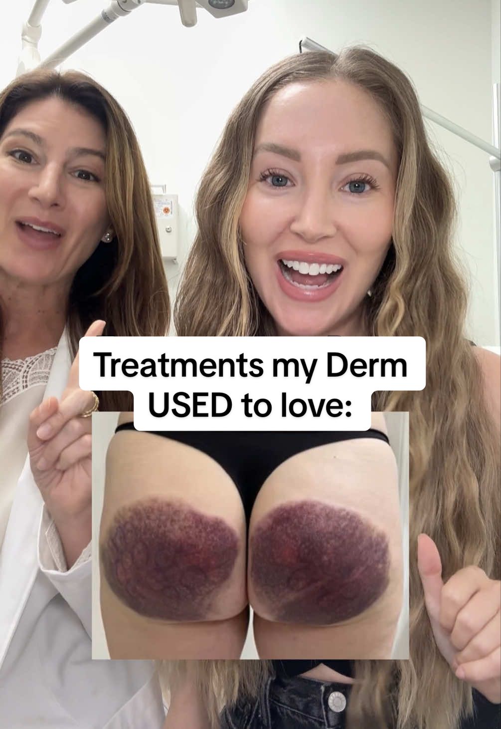 but loves them no more 😪 #kybella #coolsculpting #ulthera #qwo @DrClaireWolinsky 