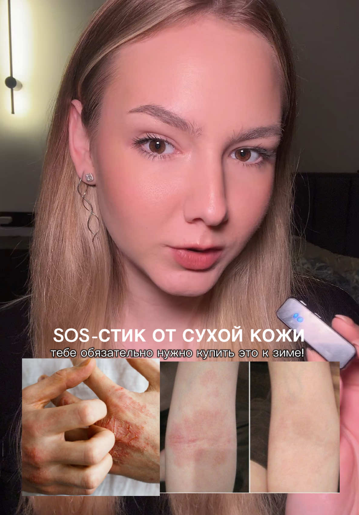 артикул ВБ: #463724515  артикул Озон: #2469831691  #атопическиймдерматит #сухаякожарук #дерматитлечение 