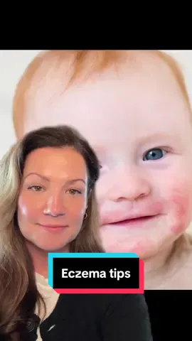 #greenscreen Eczema in children. Ways to help at home. #pediatriciansoftiktok #exzema #aquafor #MomsofTikTok 