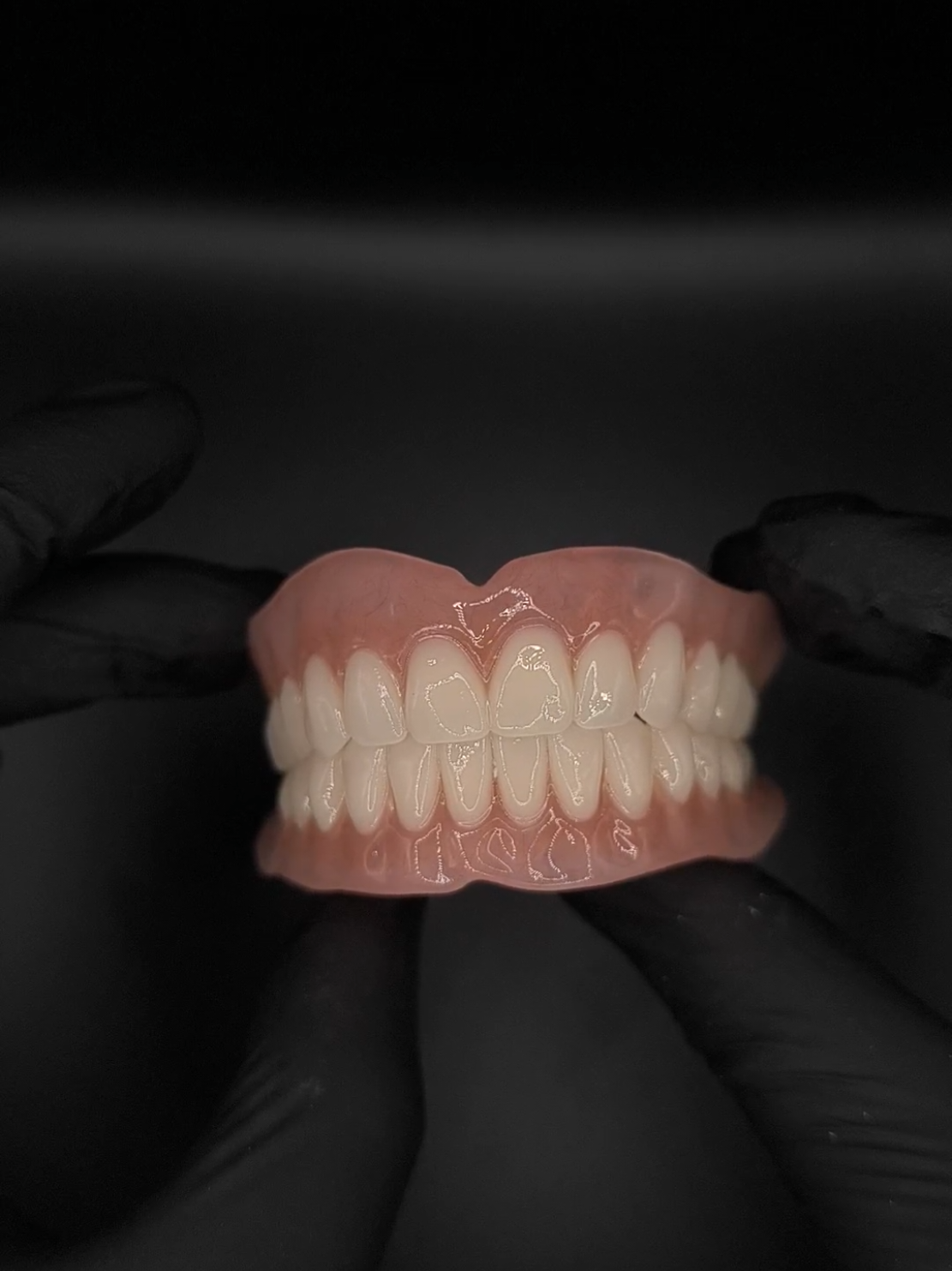 Cause i love it...😊 #ukraine #acrylicdenture #протез #dentallab #dentaltechnician 