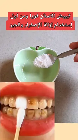 #تبييض الاسنان فورا عاول استخدام إزابة الإصفرار والجير #اسنان_بيضاء #وصفات_طبيعية #الشعب_الصيني_ماله_حل😂😂 #pppppppppppppppp 