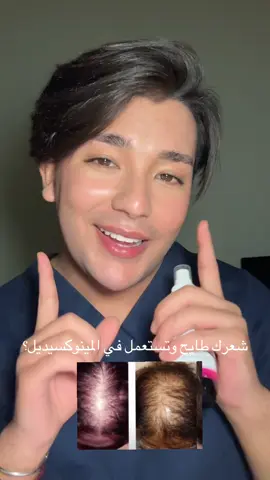 1 لازم تعملو يوميا مساج لفروة الرأس عالاقل 5 دقايق  2 تستعملوه على فروة الرأس مش مبلولة  3تنجمو تستعملوه للحواجب واللحية زادة  4تاخذو العناصر المهمة لنمو الشعر كيما بيتوتين فيتامين b12والحديد     #creatorsearchinsights #chutedecheveux #تساقط_الشعر_وعلاجه #تساقط_الشعر #minoxidil 
