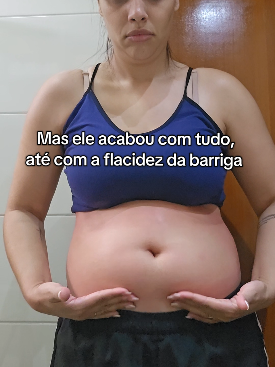 Eu não esperava por isso, olha o que esse creme rosa fez comigo. #cremerosa #estrias #flacidez  #estriasbrancas #gordura 