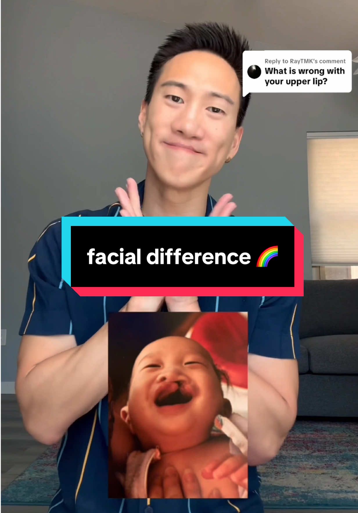 craniofacial acceptance month 🌈 #cleftlip #cleftpalate #facialdifference 