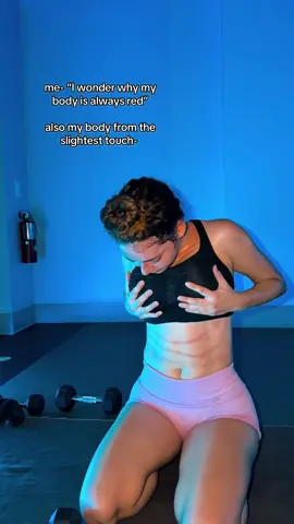 I have new bruises every day 