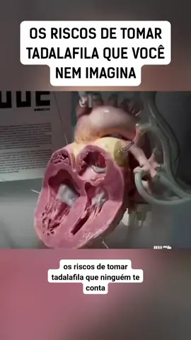 VEJA QUAIS SÃO OS RISCO DO USO DA TADALAFILA #saude #medicina #dicasdesaude #bemestar #bemestar 