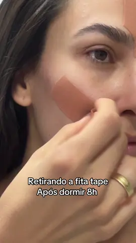 Retirando fita kinesio tape após 8h #kinesio #kinesiotapefacial #kinesiotape #sono 