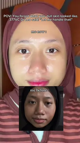Lurveeee dengan set #377VCMoist dari #drleomy  The best #drleomoisturizer comes with their serum #377vc 😍 #Moisturizer   @Dr.Leo Skincare MY @Dr.Leo-USA