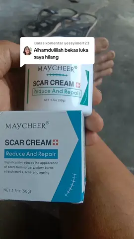 Membalas @yessyimel123scar cream penghilang bekas luka koreng  #penghilangbekasluka#lukakoreng #lukahitam #scarcream 