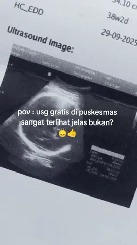 petugasnya pun ikut silent treatment 🙃☝️ #pregnancyjourney 