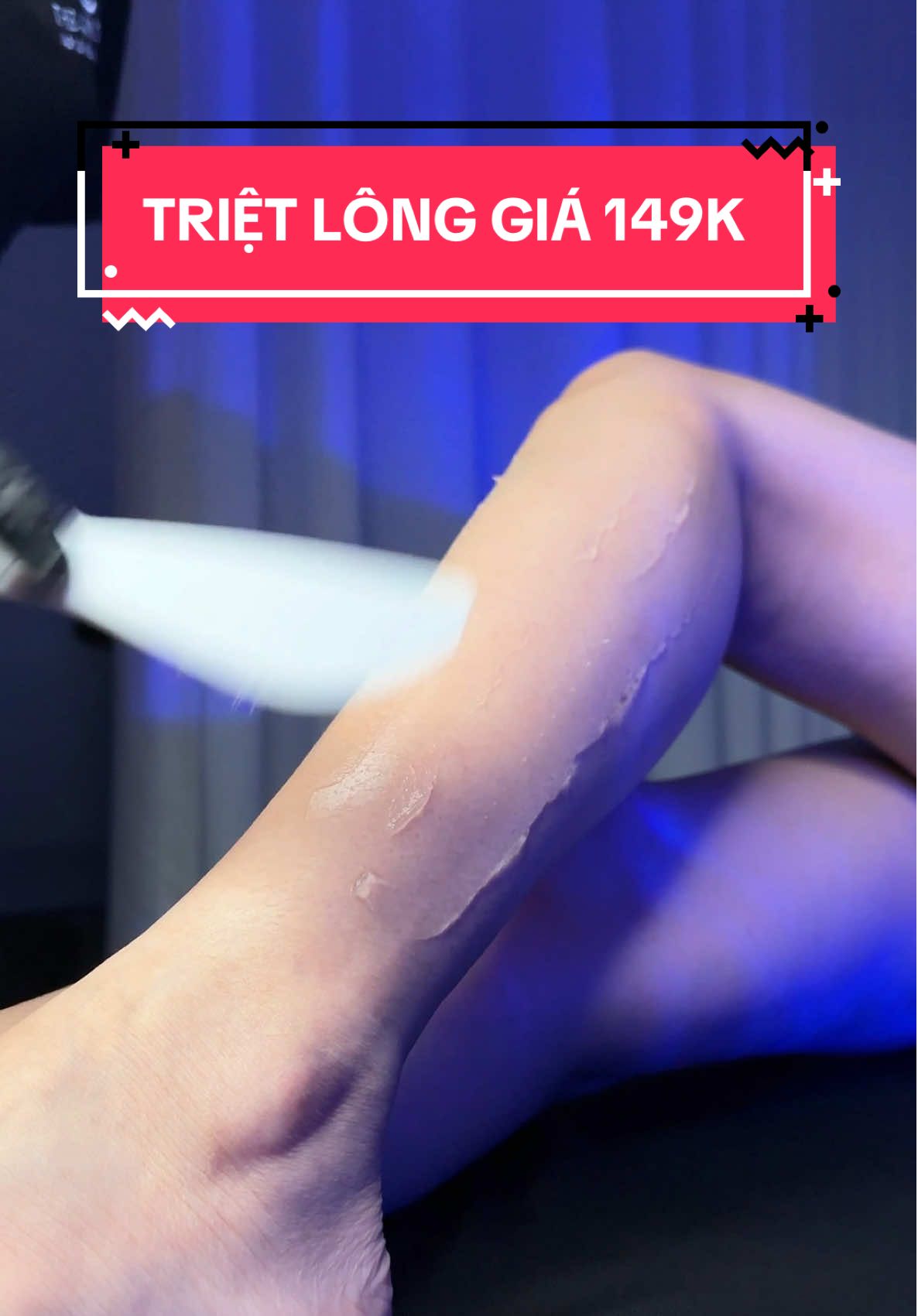 TRIỆT LÔNG CHÂN – DA MỊN MÀNG CHỈ SAU MỘT BUỔI 🌸 Video mới nhất tại TSS Glow-Lab ghi lại khoảnh khắc khách hàng triệt lông chân bằng công nghệ Diode Laser Sapphire mát lạnh, nhẹ nhàng, không đau rát. Toàn bộ quy trình được thực hiện trong không gian sạch sẽ, riêng tư, kỹ thuật viên thao tác tỉ mỉ, chuẩn y khoa. ✨ Kết quả: ✅ Lông được loại bỏ sạch sẽ, da mịn hơn thấy rõ. ✅ Lông mọc chậm, thưa dần sau mỗi buổi. ✅ Không gây thâm sạm hay kích ứng da. 📩 Hiện lịch triệt đang rất kín, nhiều khách đã đặt trước để giữ suất. 💥 Giá ưu đãi chỉ 149K/buổi, áp dụng cho khách đăng ký ngay hôm nay! ⏰ Inbox ngay để được tư vấn & giữ chỗ – đừng bỏ lỡ cơ hội sở hữu đôi chân mịn mướt tự tin diện váy ngắn! 💌 #spa #viral #tssglowlab #trietlong #tss 