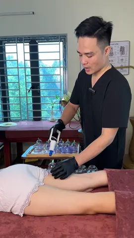 Bộ giác hơi chân không 12 cốc giác giúp lưu thông khí huyết giảm đau mỏi #giachoicaogio #xuhuong #chamsocsuckhoechudong #bogiachoi12cocgiac#giachoitrilieu 
