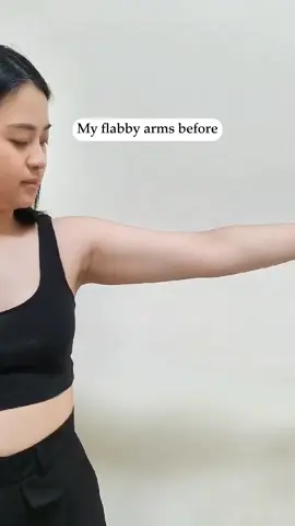 Flabby arms langsung hilang dengan Liposuction di Indskin Clinic🤩 #liposuction  #liposuctionsurabaya #indskinclinic #myindskinjourney 