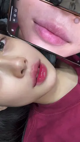 🌟Tiêm môi baby 💋 🤩 Bờ môi căng mọng xinh xắn . Không khó để thực hiện điều đó khi chọn lựa tiêm H.A tạo hình môi  #tiêmmôi  #tiêmmôibaby