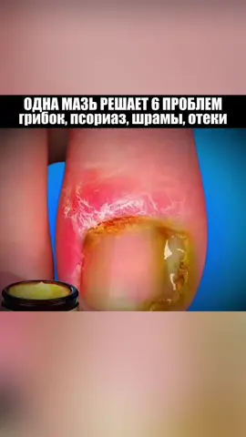Пишите слово мазь в комментариях и я вышлю вам название #здоровье #народнаямедицина #здоровьебезлекарств 