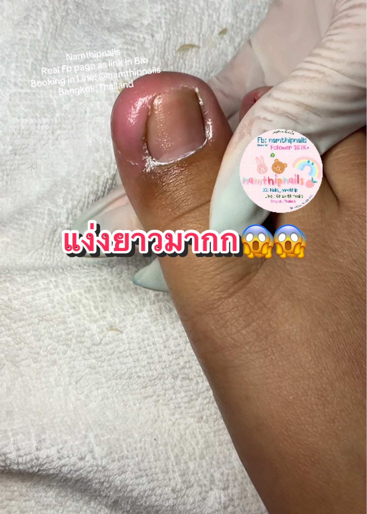 💓 #namthipnails #ตัดเล็บขบ #ตัดหนัง #ทำเล็บ #ร้านตัดเล็บขบ      Fb : namthipnails  Line : @namthipnails  นัมเบอร์วัน8 ตลาดม.ราม2  กทม  Map: namthipnails  https://goo.gl/maps/JmwpCKLfKwmhKGK96  ร้านเปิดทุกวัน เวลา12.00น-22.00น.