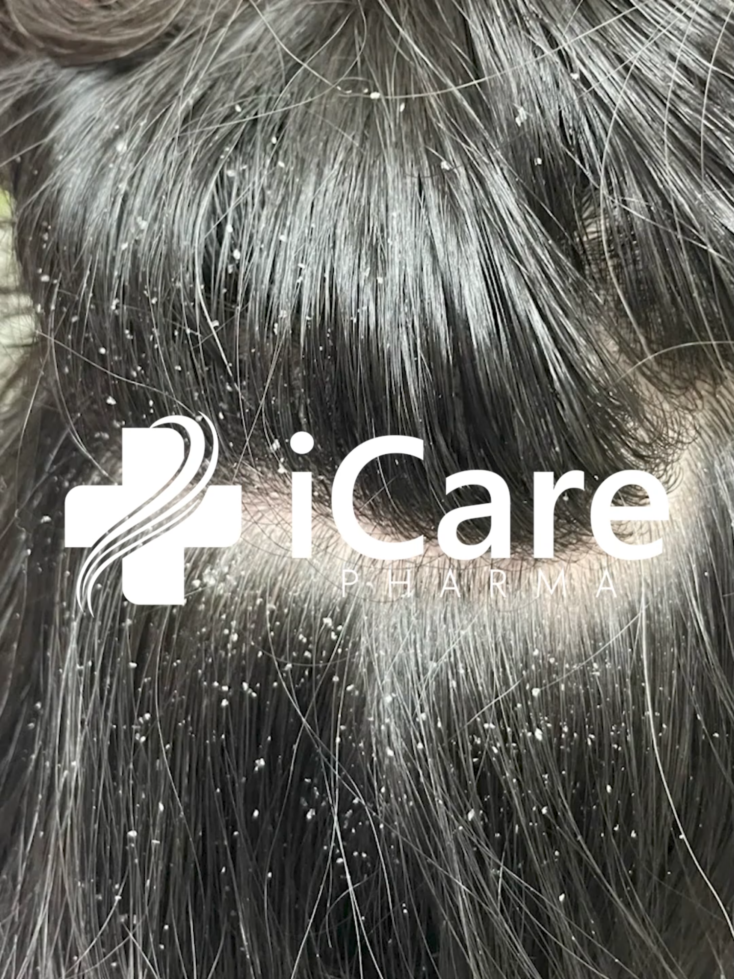 Không thể dứt điểm gàu ngứa nếu chỉ chăm chăm làm sạch từ bên ngoài. Xem ngay giải pháp. #iCarePharma #daugoiicare #daugoithaoduoc #namdadau #viralvideos #daugoitrinam #daugoi #trigau #daugoitrigau #trendingvideo #antisol #xuhuong #daugoiantisol #gau