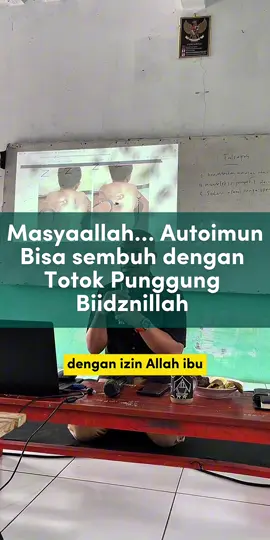Alhamdulillah totok Punggung bisa membantu mengobati Autoimun yang kata medis tidak bisa disembuhkan. Silahkan simak video sampai habis ya Bagi yg ingin datang langsung ke klinik silahkan kesini 👇 Graha Sehat Totok Punggung UAR 082310754773 Jl taman harapan baru timur lv blok p3 no.09 kel pejuang,kec.medansatria-kota bekasi 📍 Google Maps Totok punggung ust Abdurrahman Taman Harapan Baru (THB) https://maps.app.goo.gl/feditrEHfvvtuTLS9 📍 Google Maps Totok Punggung ust Abdurrahman Jatiluhur Jatiasih  https://maps.app.goo.gl/ebcrstUzRwLDewA98?g_st=ac Jl. H Dehir gg lancim no.125 RT/RW 008/002 Jatiluhur kec. Jatiasih kota Bekasi 📍Google Maps Totok Punggung ust Abdurrahman Huma Akasia https://maps.app.goo.gl/WPk9kgoPn2e85Xik9?g_st=ac Jl. Komp. Huma akasia, RT. 003/006 Jatiwarna kec. Pd melati kota bekasi Buka setiap hari Pukul 08.00 - 16.00 WIB Dengan tarif terapi 120.000 / sekali terapi  Durasi terapi 45 - 60 menit  Tidak ada Pendaftaran Online, Pendaftaran Langsung di klinik ☺️ #autoimun #UAR #totokpunggung #sehatalami #sehattanpaobat @ToPung UAR 