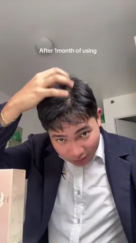 #stitch with @AirportGroundCrew✈️  medio kumapal naman sya kaso mabagal lang pero keri naaaa  #hairgrowth 