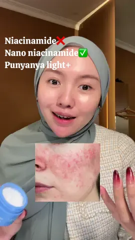 Yg suka niacinamide tp versi lebih gentle dan didompet tetep aman☝🏻 Brand @lightplus tp lininya wardah nih, makanya🔥 Full reviewnya👉🏻 #reviewlightplus #lightplusfacewash #lightplusmoisturizer #lightplusbywardah #brightening #glowing