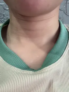 Hồi xưa nghe các cụ bảo có bầu hay k thì nhìn cổ nó là biết😍😍😍