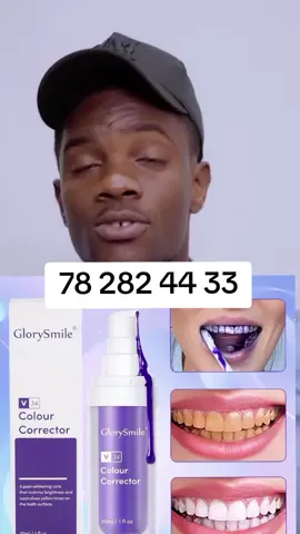 #glorysmile #astuses #VoiceEffects #blanchissemntdentaire #senegalaise_tik_tok🇸🇳pourtoichallenge 