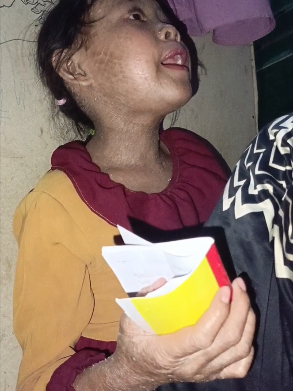 tabarakallah cintaku#anakistimewa #penyakitlangka #surahannaba #fypage 