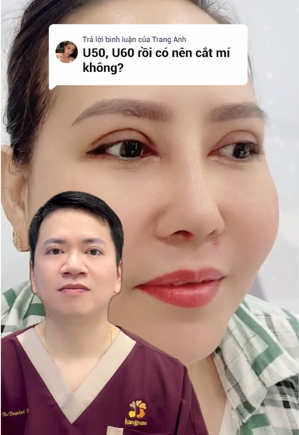 U50, U60 cắt mí có an toàn không, hiệu quả ra sao và cần lưu ý điều gì #catmi #hoidapthammy #LearnOnTikTok #benhvienthammykangnam 