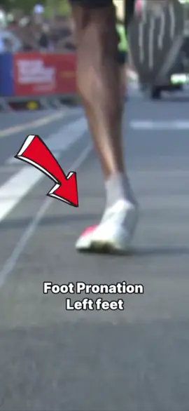 Sebastián Sawe flying at 2:51/km pace to win the Berlin Marathon 2025… but take a closer look 👀. His stride shows a very strong pronation, especially on the left foot. 🏃‍♂️ And he’s doing it in the Adidas Adios Pro Evo 2, one of the fastest shoes on the market. 🤯 Seeing this level of pronation in a world-class athlete is a reminder that even at the elite level, biomechanics are never perfect. 👉 Does it surprise you to see a world champion running with this much pronation? #RunningManOnTikTok #marathon #adidasrunning 