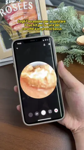 La stessa paletta per le orecchie nel negozio di raccolta delle orecchie#tiktokshop #ear #fyp #tiktokshopblackfriday #spotlightfinds 