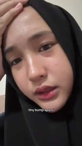 macam gampang lah tiny bump