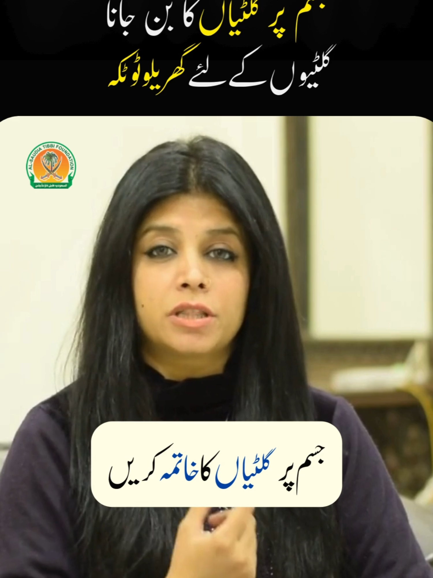 Giltyon ka asaan gharelu nuskha 🍯✨ Body par giltyon ki pareshani? Janiye haldi, shahad aur sarson ke tail se ek asaan desi nuskha jo aap ghar par try kar sakte hain. Doctor se mashwara zaroor karein. Some people develop painful lumps on body or neck. Here’s a simple desi remedy with honey, turmeric & mustard oil that may help. Always consult a doctor first.  ⚠️ This video is for educational purposes only. 🌿 It is based on cultural and traditional practices, a traditional home remedy,  not medical advice. Always consult a qualified health professional before trying any remedy. Follow @alsaudiatibbi.foundation for more herbal remedies & health tips 🌿 #fyp #foryou #herbalremedy  #naturaltreatment #healthtips #naturalremedy #TrendingNow