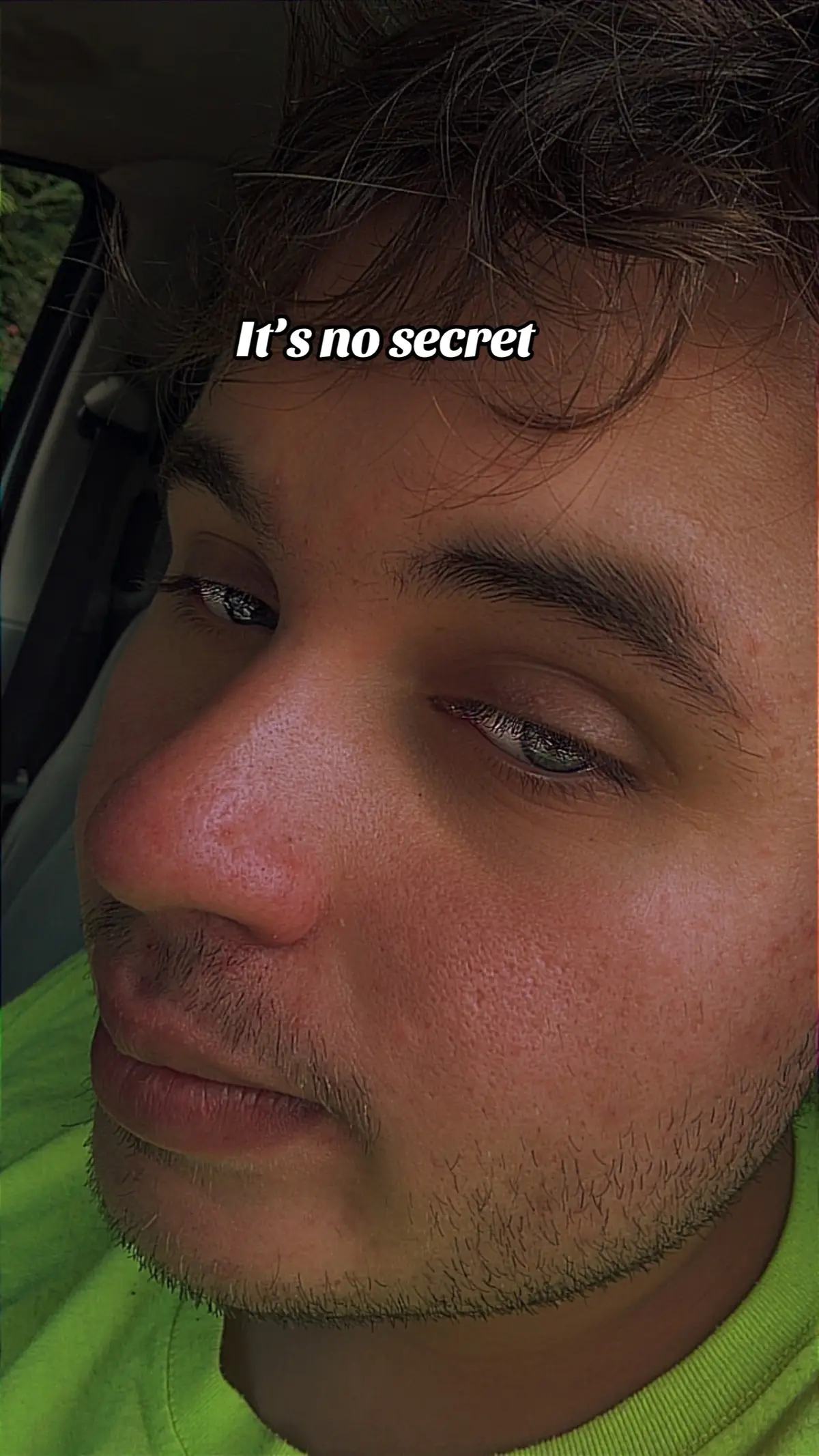 #fypシ 