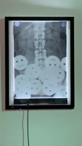 Uh Oh. Come back tomorrow at 10am ET to see what the diagnosis is. @Spirit Halloween 