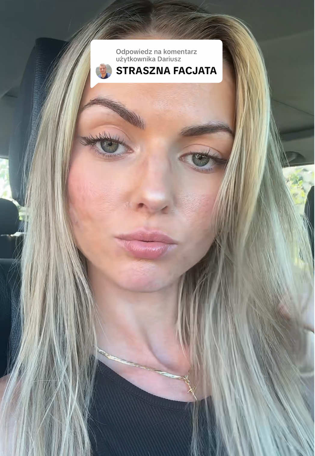 Odpowiadanie użytkownikowi @Dariusz #dlaciebie #dc #tradzik #realskin #acne 