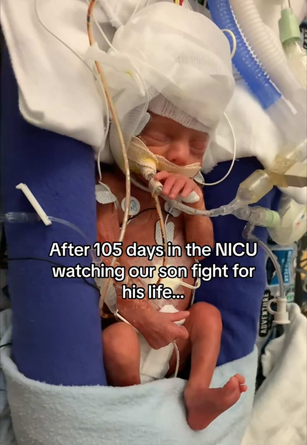 This week will always hit me hard.  ❤️ #nicubaby #nicu #preemie #lifesupport #prematurebaby 