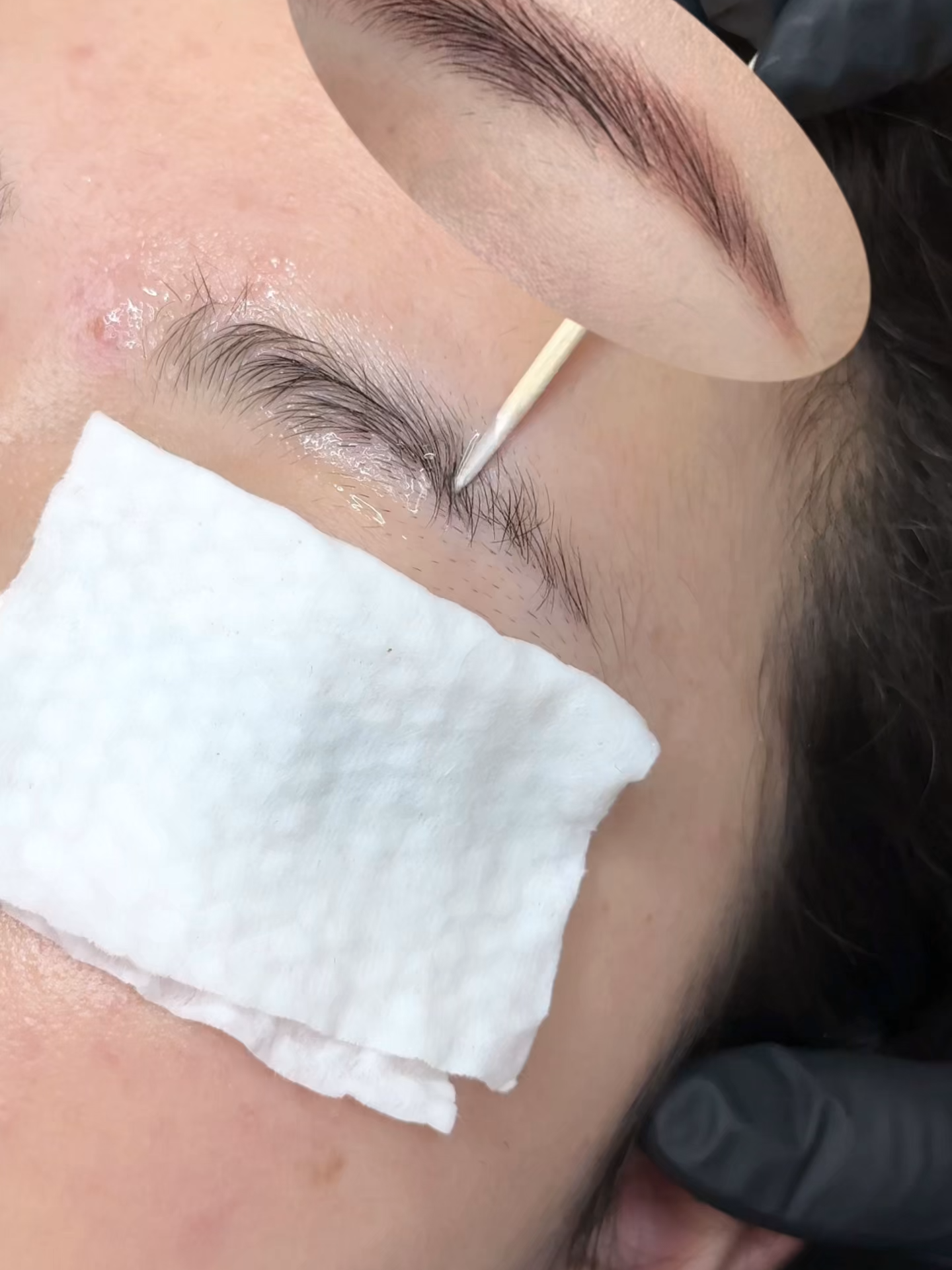 another eyebrows removal in an instant with laser treatment #eyebrowremoval #tattooremoval