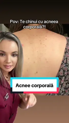 Pentru a ține sub control acneea corporală, sunt câteva măsuri simple și eficiente: 	•	Igiena corectă – duș imediat după antrenament sau transpirație abundentă; folosirea unor geluri de curățare blânde, non-comedogene. 	•	Exfoliere regulată – pentru a preveni blocarea porilor și acumularea celulelor moarte. 	•	Îmbrăcăminte lejeră – materiale respirabile care reduc frecarea și retenția de umiditate. Substanțe utile în produsele anti-acnee corporală În alegerea produselor de îngrijire, caută ingrediente cu eficiență dovedită: 	•	Acid salicilic (BHA) – pătrunde în pori, dizolvă sebumul și previne formarea coșurilor. 	•	Peroxid de benzoil – reduce bacteriile care favorizează acneea și inflamația. 	•	Acid glicolic sau acid lactic (AHA) – exfoliere chimică delicată, uniformizează textura pielii. 	•	Niacinamidă – calmează inflamația, reglează producția de sebum. În cazurile persistente sau severe, este recomandată consultația la dermatolog, care poate prescrie tratamente topice sau sistemice adaptate fiecărei persoane.  #drralucaharnagea #acnefighter #skincare #body #foru 