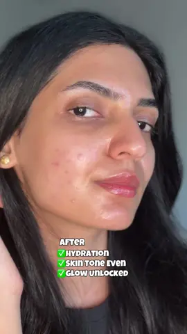 Best Korean Serum for Glowing Skin 🌟 7 days Glow up with Niacinamide  @KSECRET GLOBAL  Seoul 1988 Glow Serum Niacinamide 15% + Yuja — Concern Dull & Dry skin, pigmentation, Uneven texture, Trouble Skin  — Benefit  Anti-aging, Brightening, Improves Skin Tone, Hydration  — Skin Type  For all skin types, especially for dull & dry skin  #KSECRETGlowChallenge #KSECRET #seoul1988 #darkspots #koreanskincare 