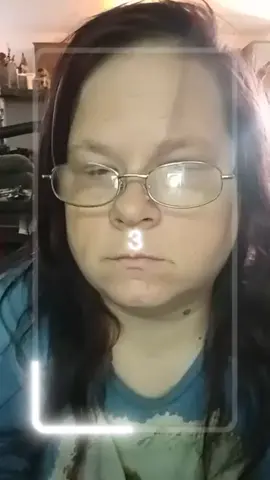 #fox #fyp #featurethis #featureme #animals 