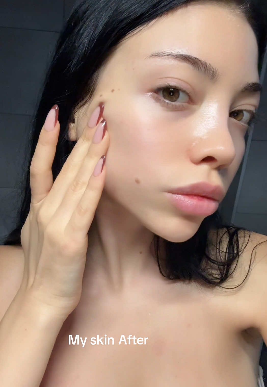 il PRX-T33 è un trattamento biostimolante che si applica in studio in soli 10-15 minuti, senza aghi e senza tempi di recupero. Stimola la produzione di collagene, migliora la grana della pelle, illumina immediatamente e dona un effetto glass skin già dopo la prima seduta. In 24 ore le piccole imperfezioni iniziano a sparire e nei giorni successivi la pelle continua a migliorare, diventando sempre più bella e luminosa!! Ho fatto il trattamento dalla @dott.ssa_carmendeluca, lei è davvero la migliore 🤍 #skincare #prx #glassskin #glowyskin #darkspots 