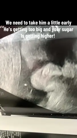 9/18/25.. my son entered the world! Lord we thank you!!🙌🏾 #csectionmom #laboranddelivery #babyboy #fyp #Love 