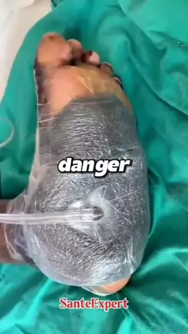 Partie 79 Recette naturelle peut sauver ta vie si ton sucre atteint 300!#diabete #santenaturelle #insulinenaturelle #stopdiabetes #AstuceSanté 