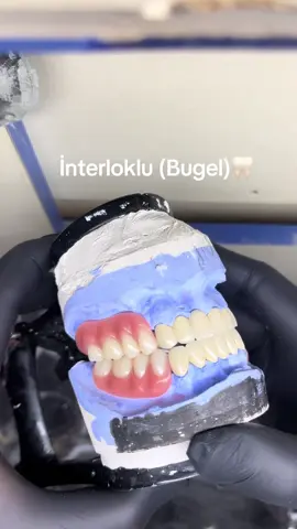 #dişhekimliği #dişkliniği #implant #bugel #keramikaestetic 