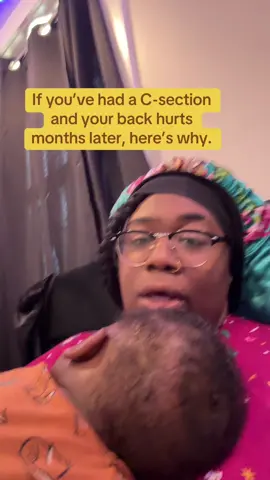 If you’ve had a C-section and your back hurts months later, here’s why. #pregnant #pregnanttiktok #csectionmom 