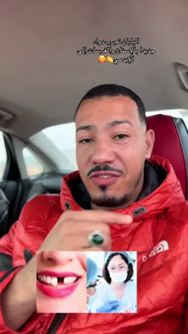 اليابان تجرب دواء جديدا بالإسنان والغرسات إلى الإبدمي👏🥰#المغرب🇲🇦تونس🇹🇳الجزائر🇩🇿 #المغرب #سعوديه #معلومات #مراكش 