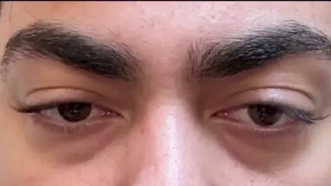 eye pill #eyepill #eye #eyebrows #eyemaxxing 