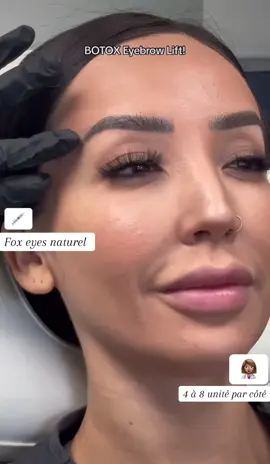 ✨ Botox Fox Eyes ✨ Cette technique vise à ouvrir et allonger le regard en relevant légèrement la queue du sourcil grâce à de petites injections ciblées de toxine botulique. Le résultat est un effet “regard de biche”, plus étiré et lumineux, sans chirurgie. ✔️ Regard lifté et élégant ✔️ Effet naturel et subtil ✔️ Procédure rapide, résultats visibles en quelques jours.             #foxeyes #botox 