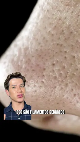 🧪 Pele oleosa, poros e cravinhos? A dupla imbatível da @Creamy Skincare resolve: ✨ Solução de Ácido Salicílico – desobstrui os poros, controla oleosidade e combate cravos. ✨ Ácido Glicólico – renova a pele, uniformiza a textura e ainda dá glow. A união que deixa a pele mais lisinha, uniforme e com aquele viço que a gente ama 💙 🏷️ Cupons Creamy: • PRIMEIRAMIGUEL = 15% OFF na 1ª compra (sem mínimo) • MIGUEL = 10% OFF nas demais compras #CreamySkincare #SkincareComMiguel #MIGS #advogadodabeleza #CuidadosComAPele 