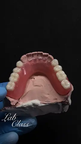 Flex parcial inferior.💎 Gostou? Me segue para não perder os próximos trabalhos #fyp #foryou #protesedesilicone #proteseflexivel #odontologia 